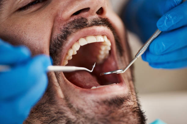 Best Cosmetic Dentistry  in Meadow Glade, WA